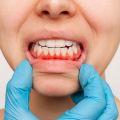 Brooklyn Periodontist