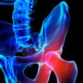 Hip Injuries Treatment
