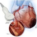 Resting Echocardiogram in New York Cardiac Diagnostic Center