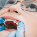 Help your child avoid functional dental problems and to correct them in the future.