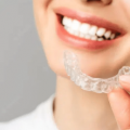 Every important & interesting thing you may need to know about clear aligners in Malaysia