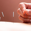 Do you want to know why Acupuncture is relaxing?