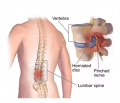 Back Injury Treatment Specialists in NJ