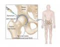 Hip Injury Treatment Specialists in New Jersey