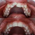 Children’s Dentistry – Top Rated Pediatric Dentist in Stamford