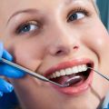 Porcelain Dental Veneers in Astoria, Queens, NY