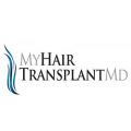 My Hair Transplant MD
