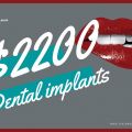 Dental Implants from Shalman Dentistry
