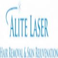 Alite Laser Hair Removal