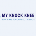 My Knock Knee Fix